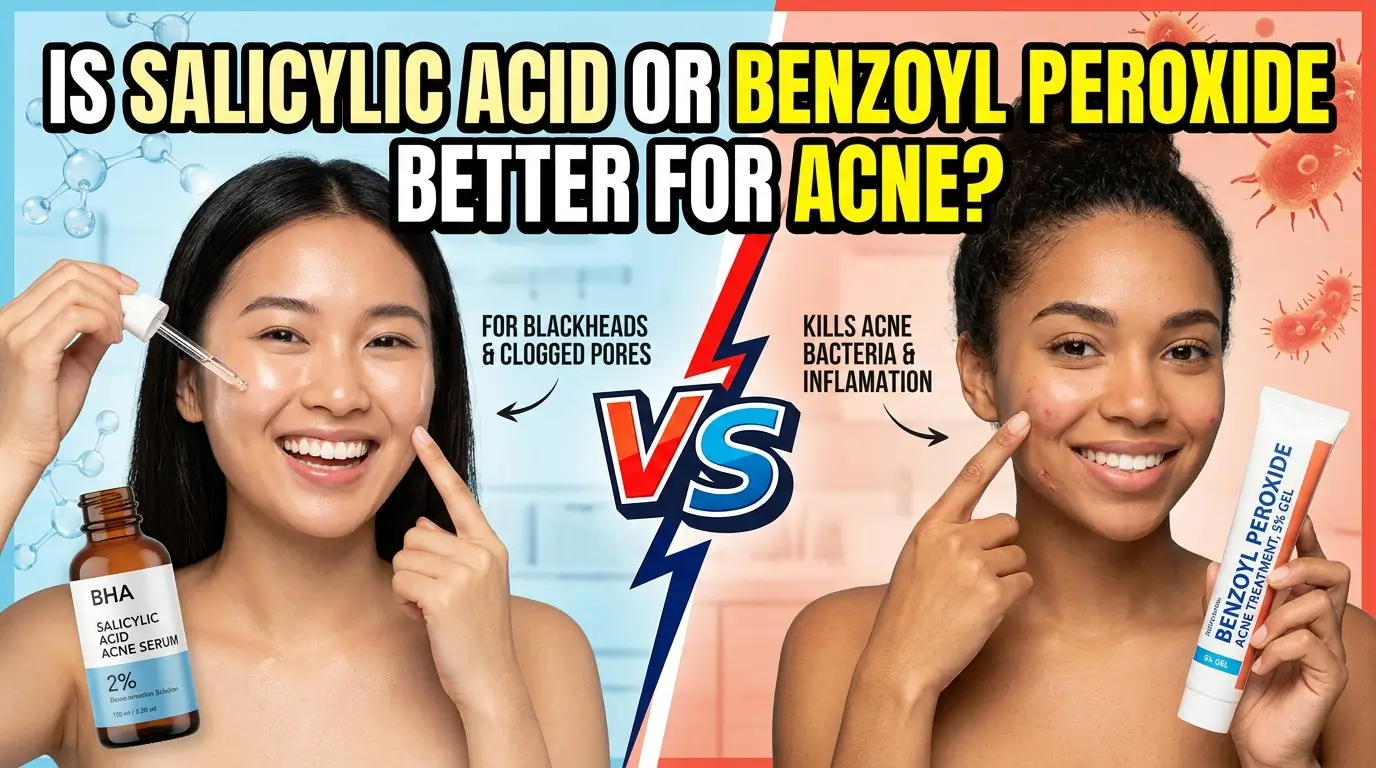 Salicylic Acid Or Benzoyl Peroxide: Better For Acne 2026